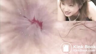 The brown side of life 463