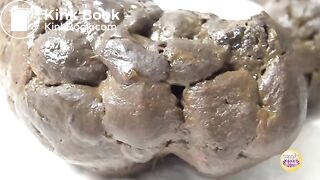 Constipation Clinic 4