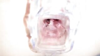 SpeculumFilledPussyPart1