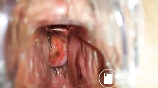 SpeculumFilledPussyPart1