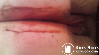 Pooping Scat tube video Scat porn Best Porn Tube Pooping gir-1