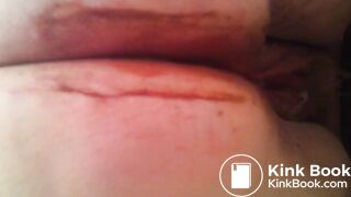 Pooping Scat tube video Scat porn Best Porn Tube Pooping gir-1