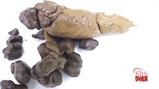 Shit on a plate and examine the shit 4