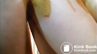 6617851