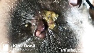 KITTY CATHERINE'S BLACK DIRTY ASS HOLE