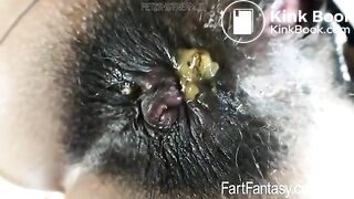 KITTY CATHERINE'S BLACK DIRTY ASS HOLE