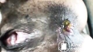 KITTY CATHERINE'S BLACK DIRTY ASS HOLE