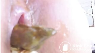 Constipation Clinic 9