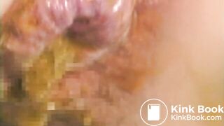 The brown side of life 625