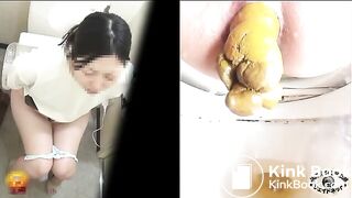 The brown side of life 731