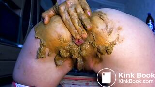 Prolapse, anal fist and scat