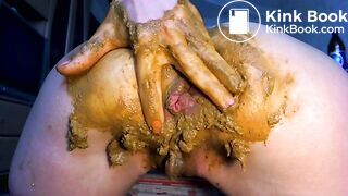 Prolapse, anal fist and scat