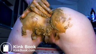 Prolapse, anal fist and scat