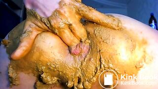 Prolapse, anal fist and scat