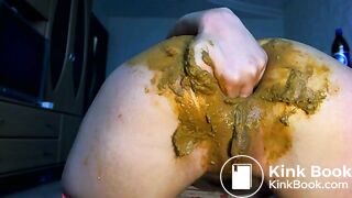 Prolapse, anal fist and scat