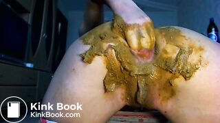 Prolapse, anal fist and scat