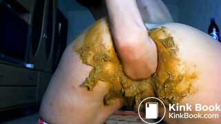 Prolapse, anal fist and scat