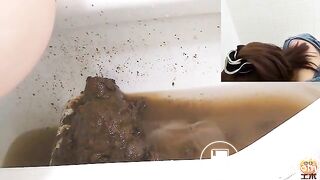 EVO Diarrhea Special Edition-part07