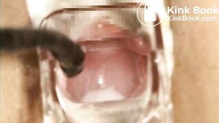 The brown side of life 757