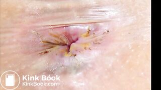 Close-up of dirty assholes in slideshow  1