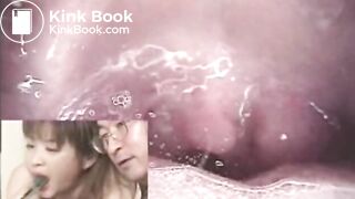 The brown side of life 464