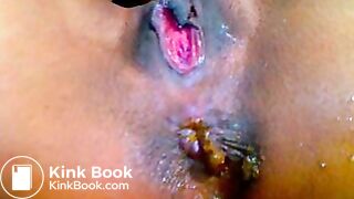 My_recorded_Cam_Sessions_-_Scat_Camgirl_VI_-_EroProfile poo