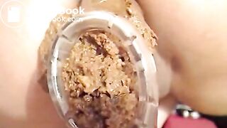scat cam shit through speculum