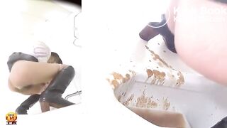 The brown side of life 1106