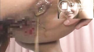 The brown side of life 459