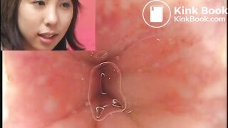 eggs and shit in the bowel