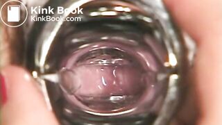 The brown side of life 624