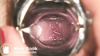 The brown side of life 624