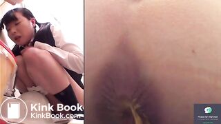 Asian Toilet Enema Constipated Two