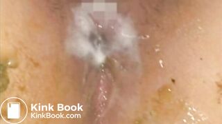 The brown side of life 452