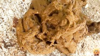 EVO Diarrhea Special Edition-part06