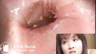 The brown side of life 601