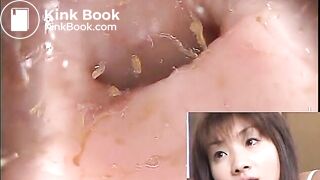 The brown side of life 601