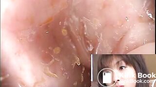 The brown side of life 601