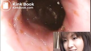 The brown side of life 601