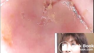 The brown side of life 601