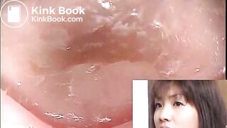 The brown side of life 601