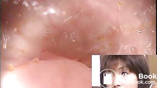 The brown side of life 601