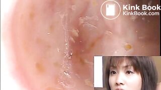 The brown side of life 601