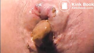 Extremely close up pooping angle