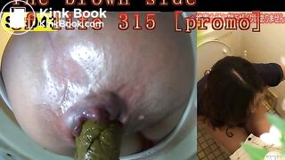 The brown side of life 315