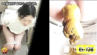 The brown side of life 479