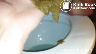 Close Up On Shitty Assfingering