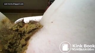 Hairy Teen Smearing Shit On Pussy