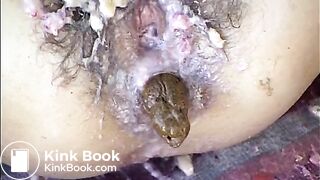Puked Pussy And Scat