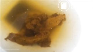 pooping shitting